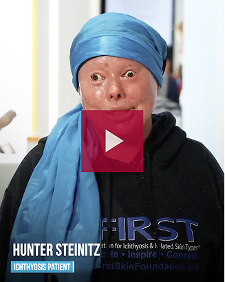 Thumbnail of video of Hunter Steintz