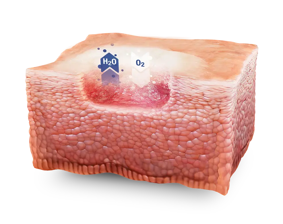 Skin graphic showing Water and Oxygen entering and leaving the surface