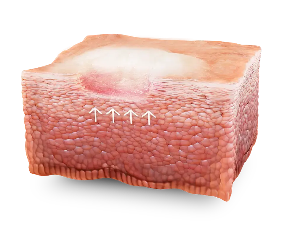 Skin graphic with arrows showing ceramide synthesis